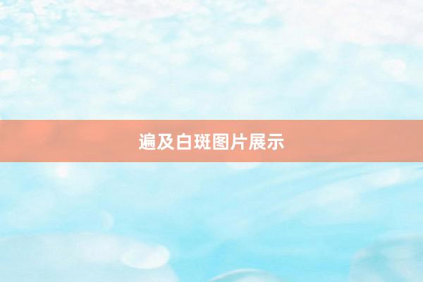 遍及白斑图片展示